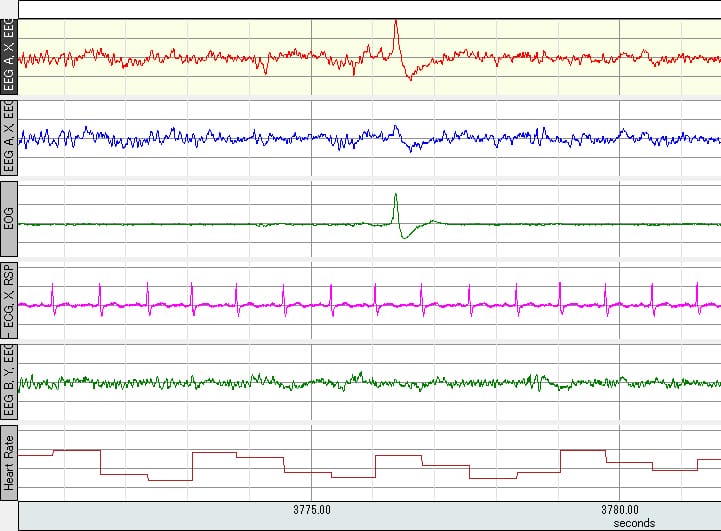 照明の照射範囲が生理・心理反応に及ぼす影響