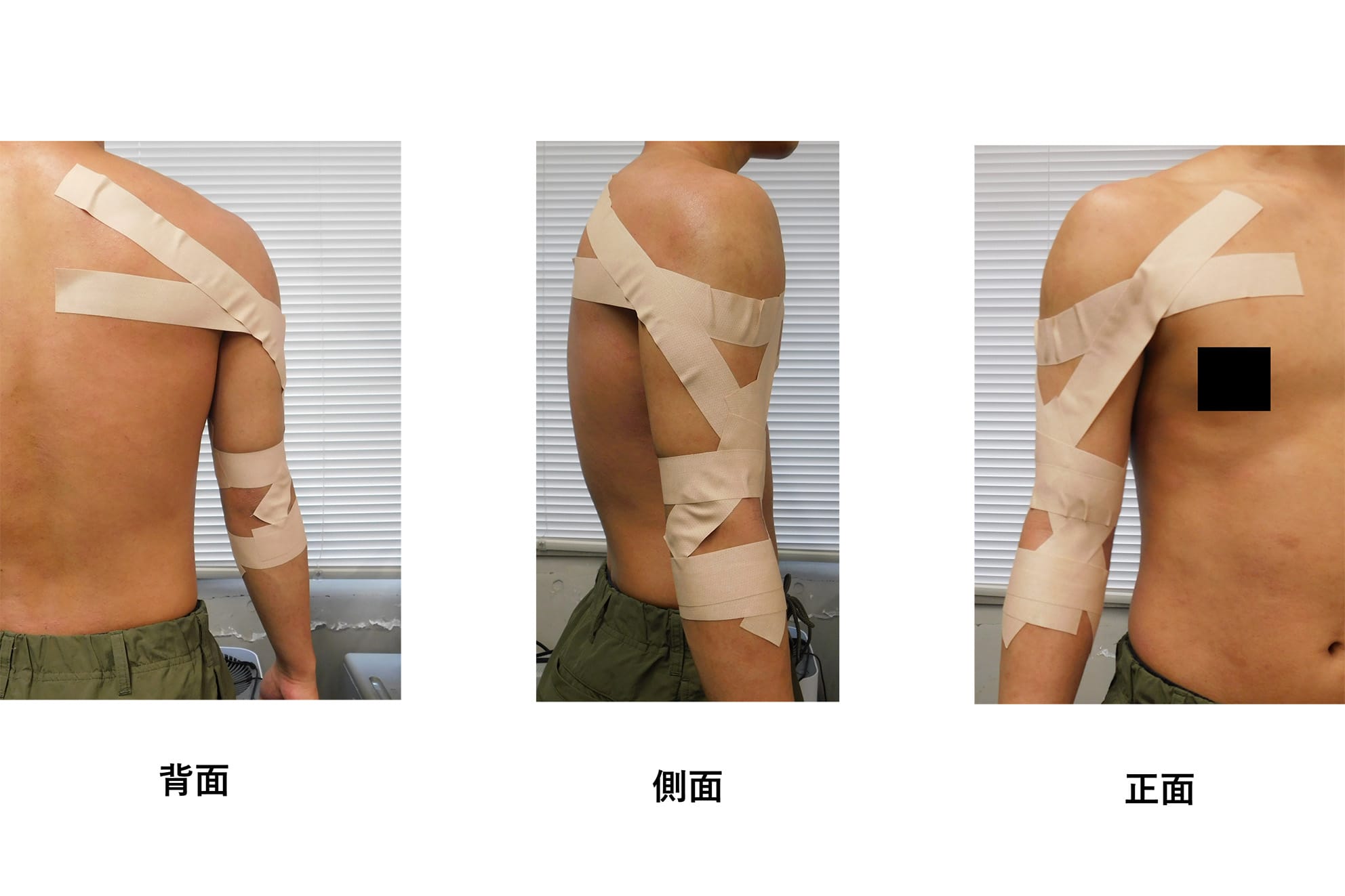 肢体不自由者の上衣着脱に配慮した衣類の開発に向けて